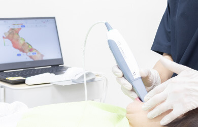 口腔内スキャナー